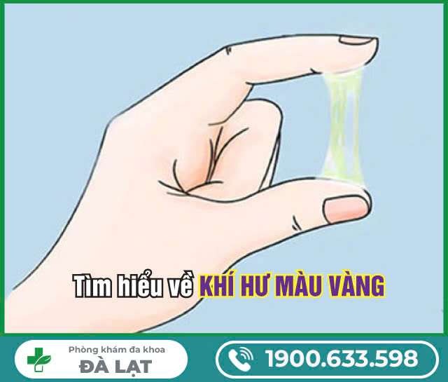 Khí Hư Màu Vàng Kèm Ngứa: Nguyên Nhân và Cách Điều Trị